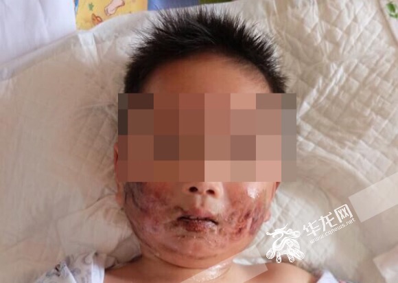 重庆3岁男童乘车坐前排险丢命 儿童乘车侥幸不得(图1)